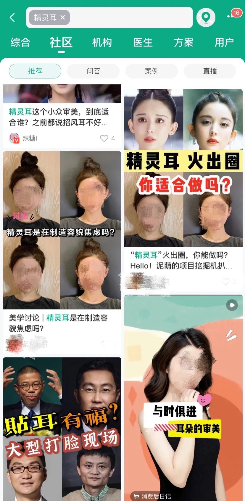 “漫画腿”、“精灵耳”的整容风，为什么越来越失控？
