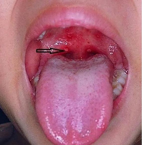 鎵嬭冻鍙ｇ梾棰勯槻瑙嗛鍔ㄧ敾,棰勯槻鎵嬭冻鍙ｇ梾瀹夊叏鏁欒偛