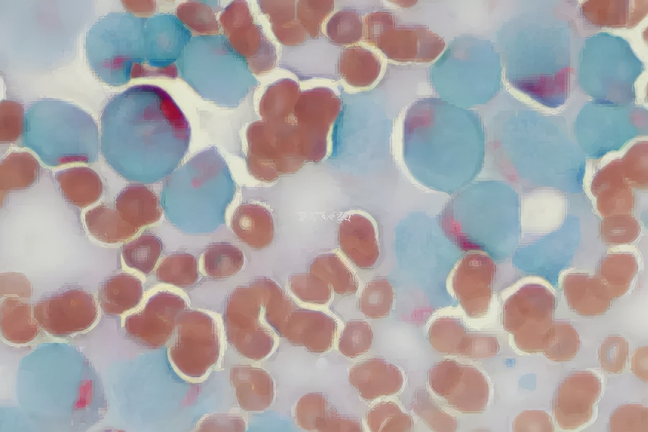 粒单不决问组化?有时还真不一定...