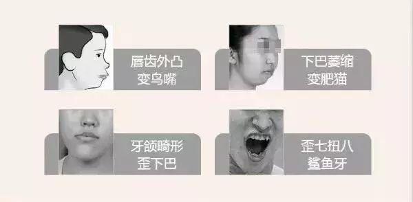 雅悦齿科种植牙,雅悦齿科口碑怎么样