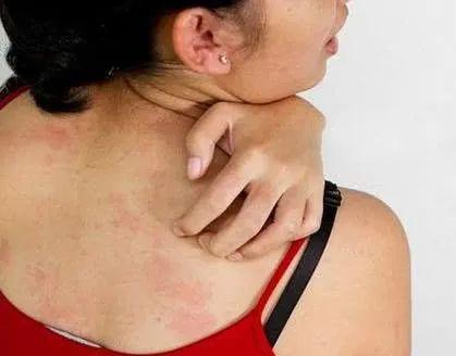 25岁女学生感冒不好，检查结果出来，5个男孩慌忙赶到医院