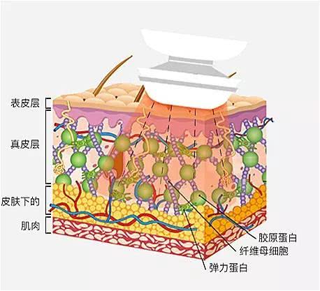 射频美容仪哪个牌子最好用,amiro射频美容仪测评