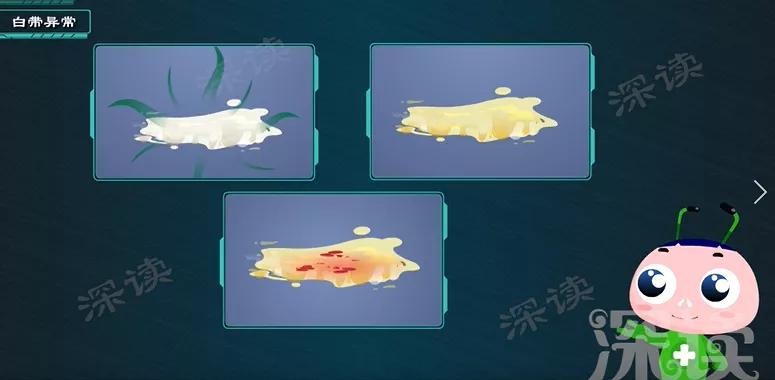 妇科盆腔炎下腹部痛,白带正常肚子疼是盆腔炎吗