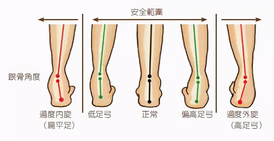 偏瘫患者异常步态的矫正方法，这些你应该知道