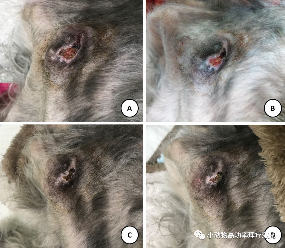 褥疮护理个案,褥疮个案护理