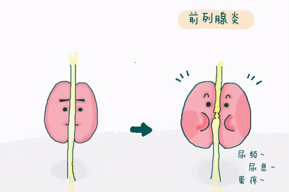 16岁早泻,未成年早泄