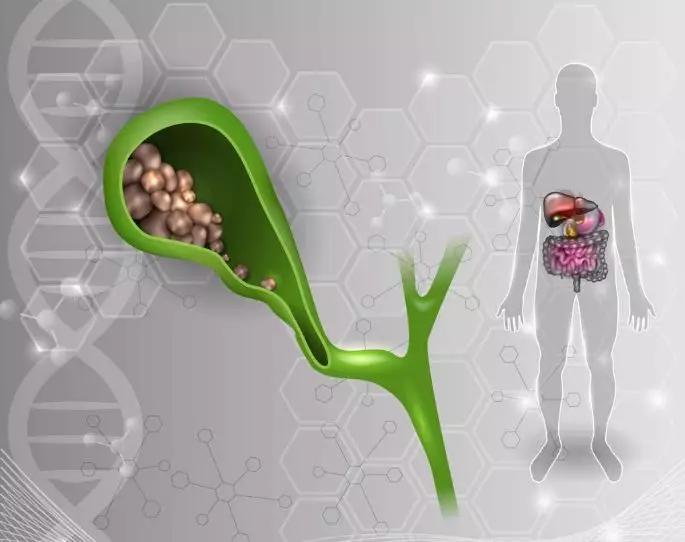 预防结石产生，从一杯碱性好水开始