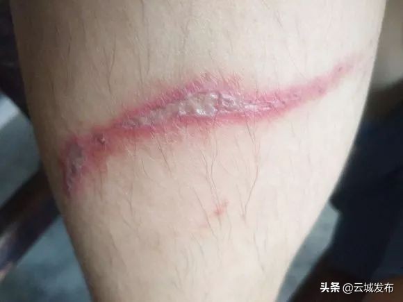 @云浮人虫出没，请注意！