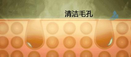 封闭性粉刺的解决方法