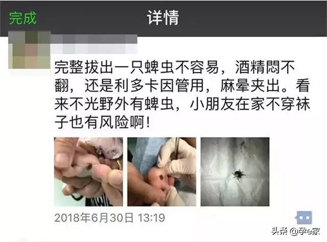 身上出现许多小黑痣,身上出现凸起黑痣一定要重视