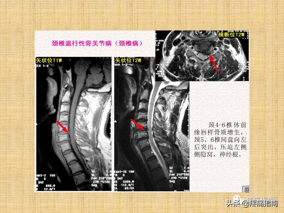 中医针灸推拿学入门,真正厉害的中医推拿