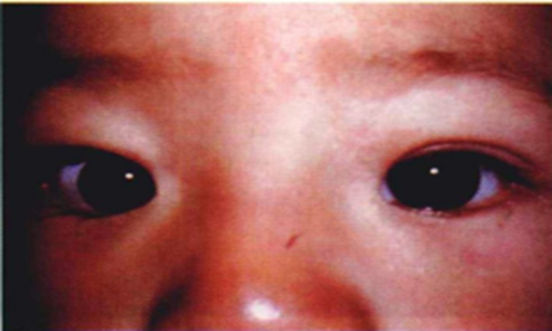 疾病与认知,疾病认知视频