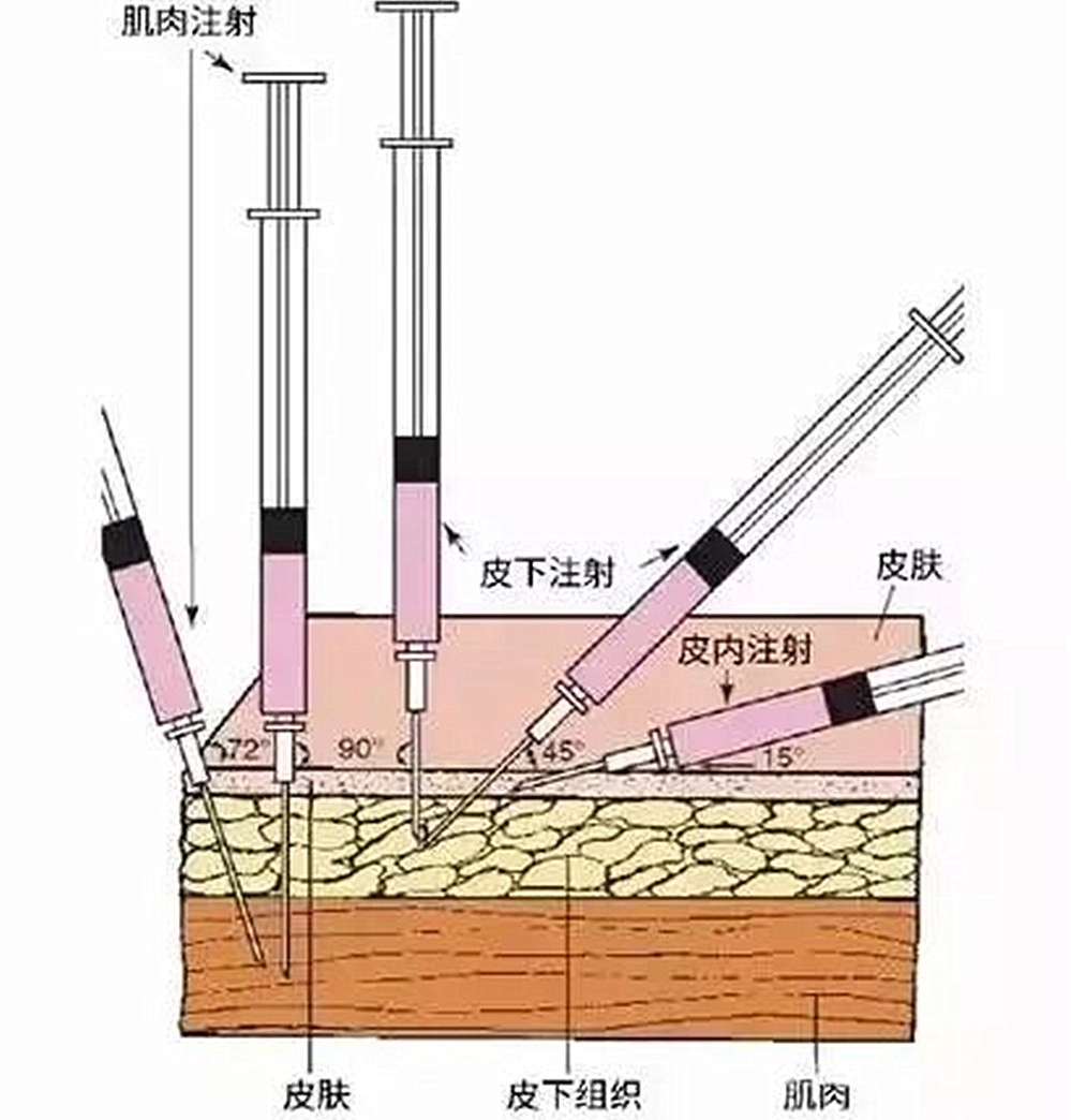 自己在家给猫咪打疫苗注意事项,自己给猫咪打疫苗会被记仇吗