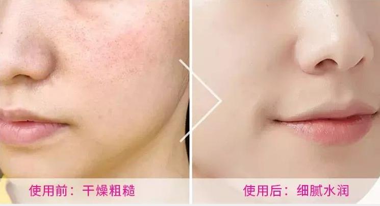 小分子玻尿酸精华液推荐第一名,玻尿酸烟酰胺小分子原液