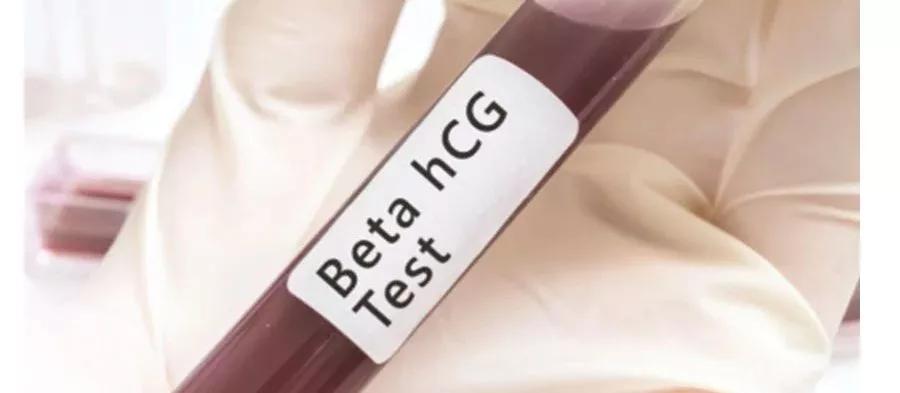 早孕期血清学筛查准确率,早孕期查哪些指标比较准确