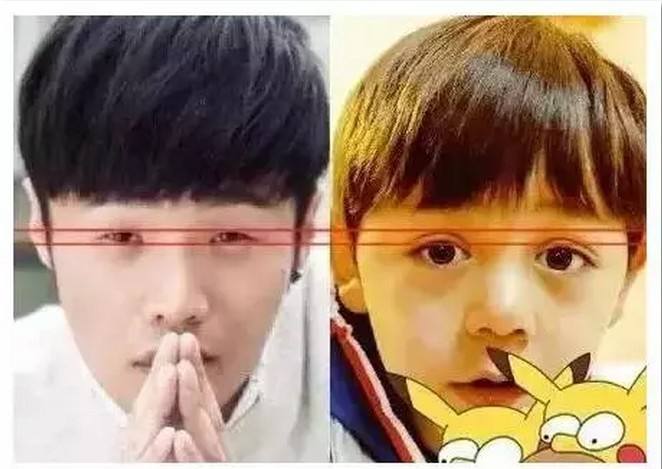 脸小能通过整容变大吗多少钱,眼睛太小怎么变大不用整容