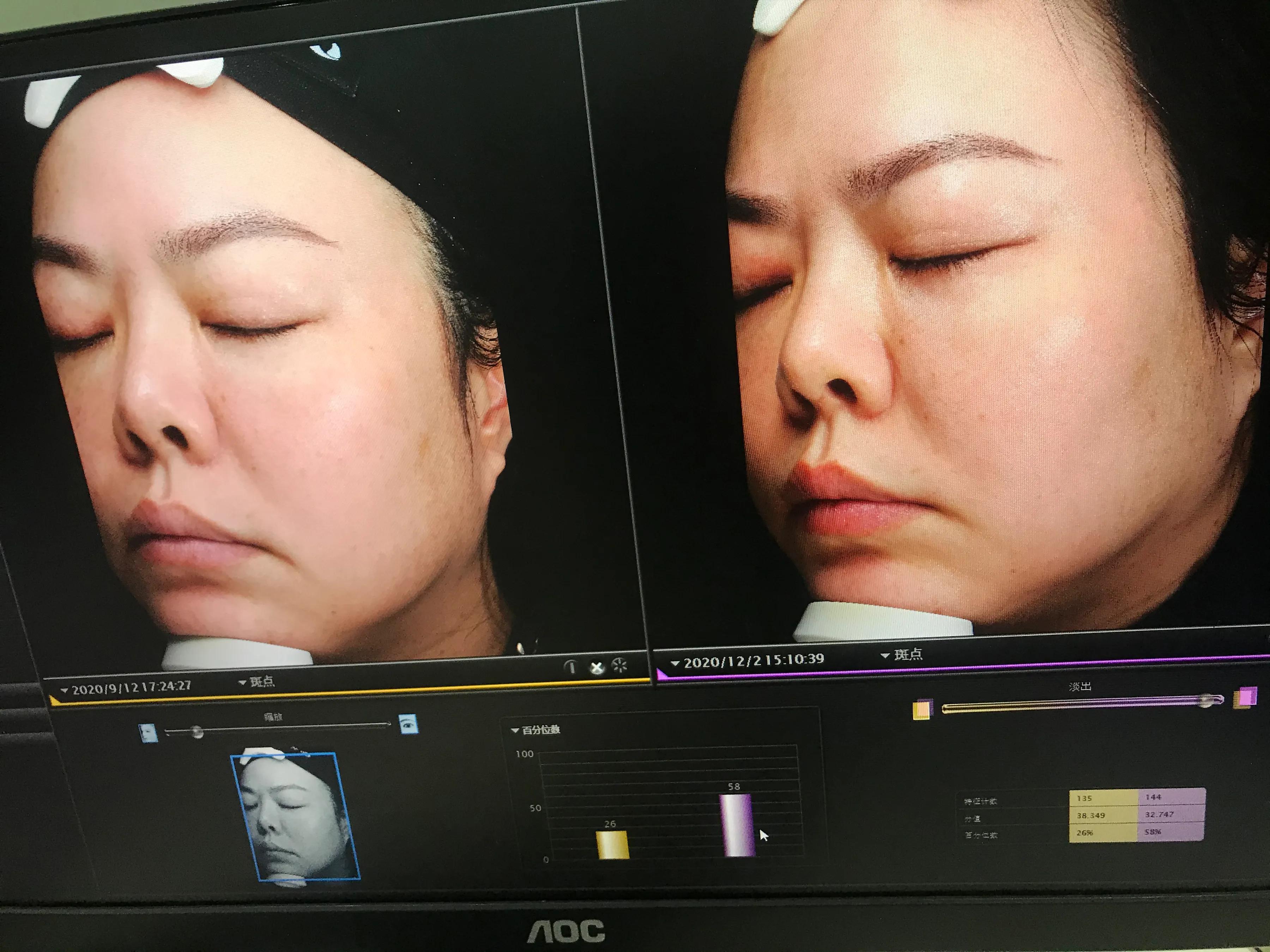 玉兰油超红瓶和sk2大红瓶,玉兰油淡斑小白瓶和sk2哪个好