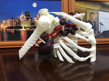 乳癌术后中药方,中医治疗乳癌晚期