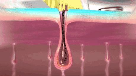 j-style冰点脱毛仪,j-style光子嫩肤脱毛仪