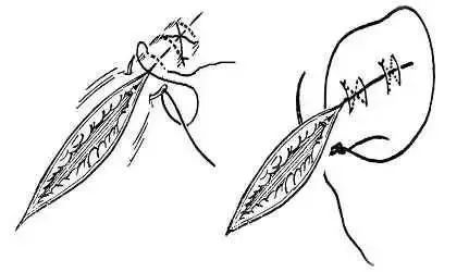 外科缝合方法笔记,兽医外科手术中最常用的缝合方法