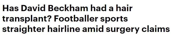 小贝为何剃光头,贝克汉姆的头秃