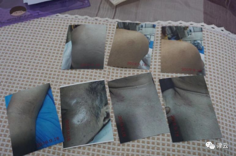 唐山64岁男子抓贼却被当成嫖客，被打后至今未得到赔偿