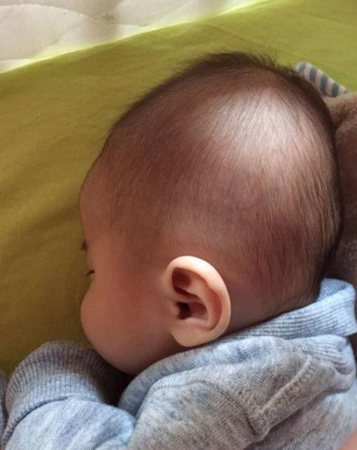 宝宝头型睡扁如何纠正,青年扁头可以通过睡姿矫正吗