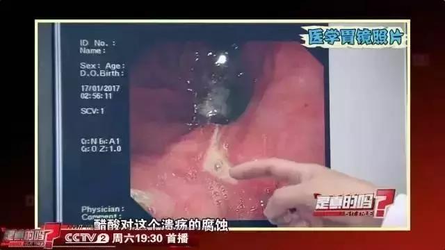 关于醋的故事,醋字的故事