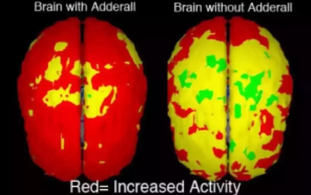 别让中国2.7亿学生，被“聪明药”送进戒毒所！
