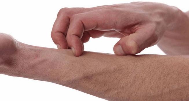 下身有几只阴虱怎么办,内裤上出现虱子卵怎么办