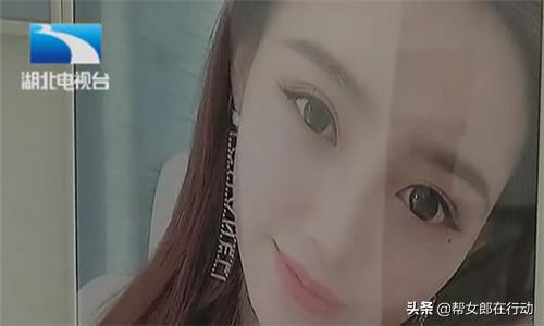 女子四次隆鼻惨毁容,女子4次隆鼻手术后变猪鼻