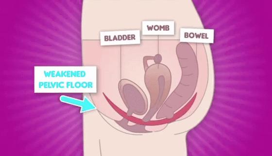 100亿活性乳酸菌,灭活乳酸杆菌