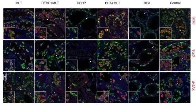 铚堟敮娲插矝娴锋磱缁存姢,铚堟敮娲插矝淇濇姢娴锋磱鐜