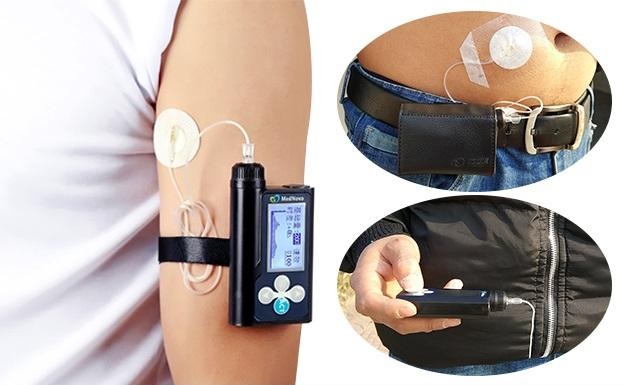 胰岛素要终身打吗,胰岛素终身打吗