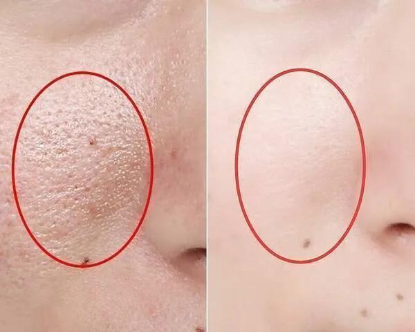 做医美的女生有多少,做医美的女生有什么特征