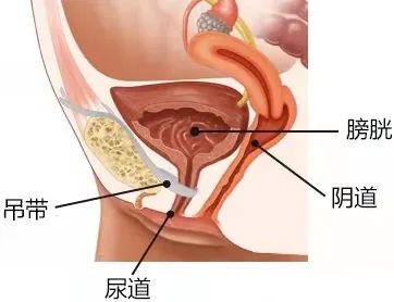 写了六年科普文,竟挡不住弟媳加入微商卖缩阴