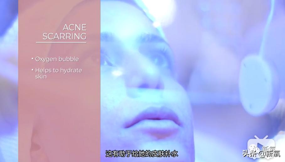 刘诗诗最近生图,刘诗诗旧照脸又胖又大