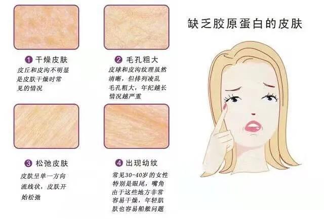 补充胶原蛋白是智商税吗,吃肉皮能补充胶原蛋白吗