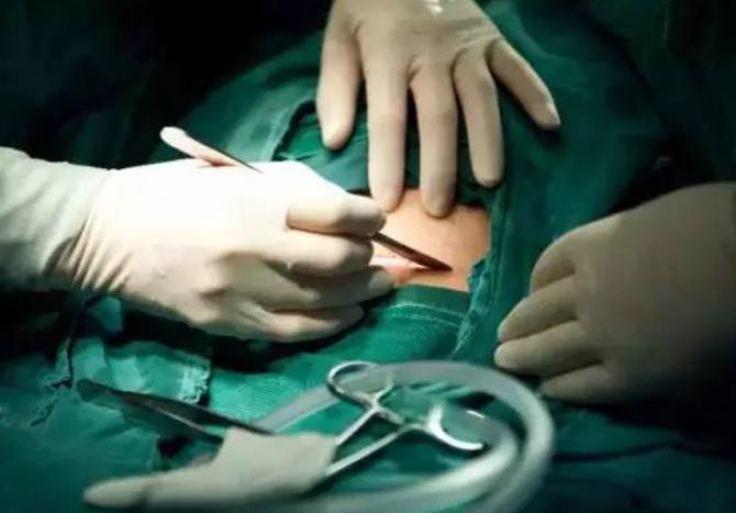 7张图揭露产妇“剖腹产”全过程，男人都该看，网友：母爱太伟大