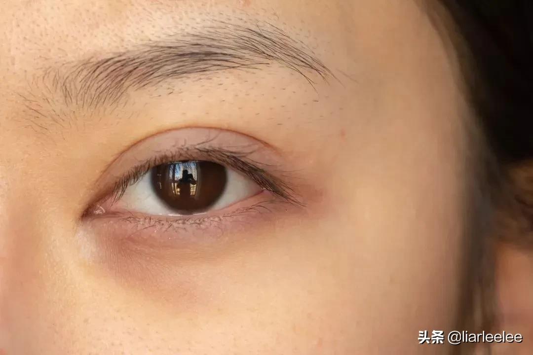 眼角皱纹最显老要注意防晒,眼角皱纹去皱最有效的方法