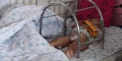 本想让宝宝凉快一下，没想到*处私**感染、蛋蛋被夹坏、面瘫、中毒..