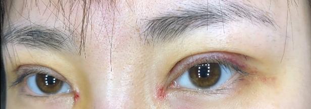 土肥圆怎么逆袭最好,土肥圆的逆袭效果