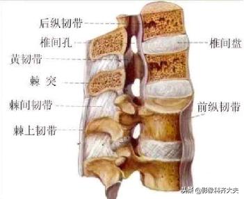 腰椎间盘突出最好的影像诊断方法,腰椎间盘突出的影像学检查