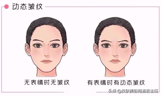 长皱纹多了用什么方法去皱纹最好,满脸皱纹最有效去皱方法