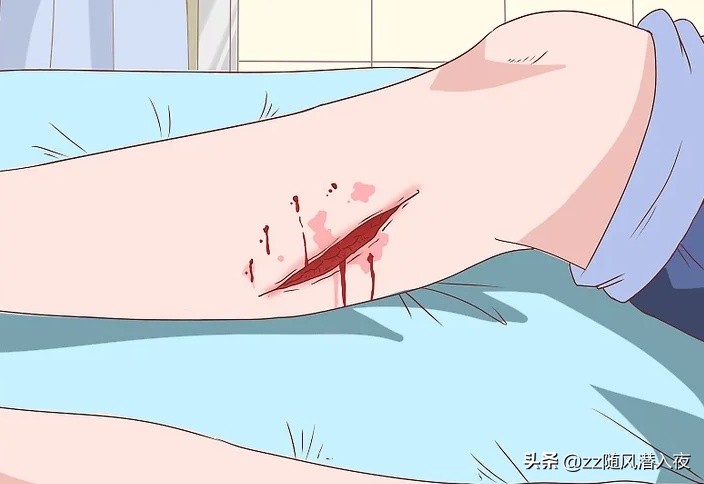 狗咬狗狗的伤口怎么处理,狗被狗咬的伤口肿了怎么办