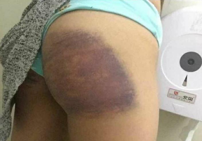 因举报豫章书院殴打、虐待、囚禁学生，志愿者持续受扰被迫离职，有人抑郁自杀，有人被威胁“断手”