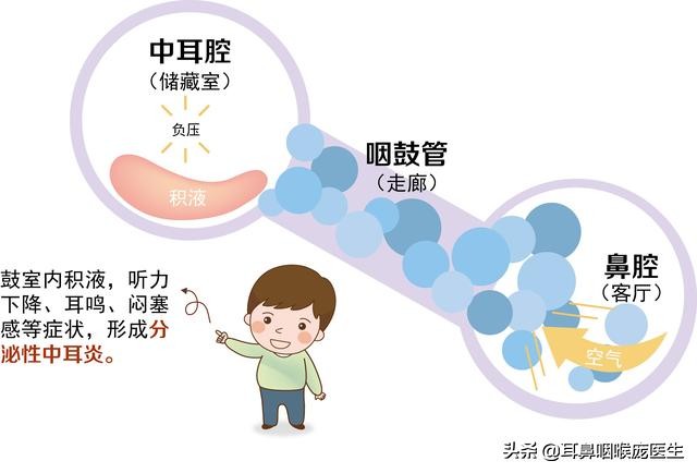 鼻炎导致耳朵闷是怎么回事,鼻炎出现耳闷是严重了吗