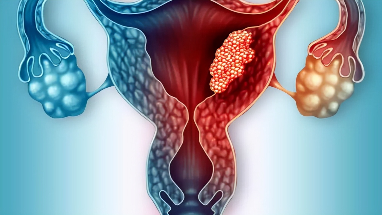 女人失去子宫会怎么样,女人失去子宫有什么后遗症