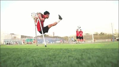 单腿截肢后又双腿截肢,单大腿截肢能游泳吗