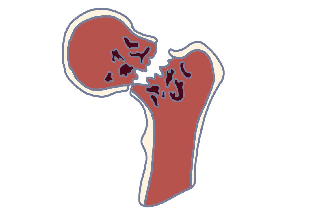 别惹你妈生气,过年不回家惹父母生气了